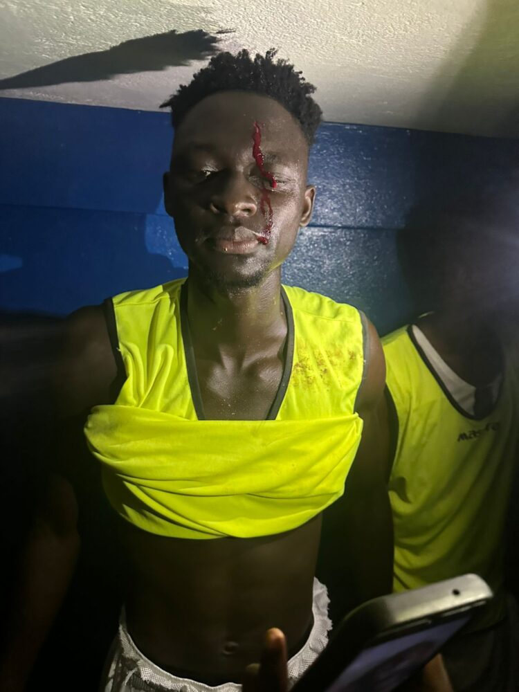 5è j LGFP-Kankan : Des joueurs du Wakrya AC, victimes de graves violences verbale et physique !